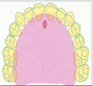 Fig. 1 Palatogramme.