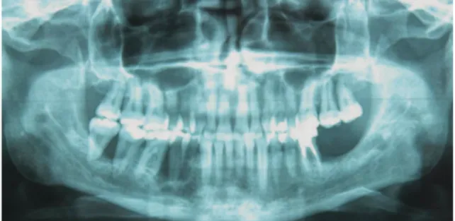 Fig. 4 Pièce anatomique d’exérèse.