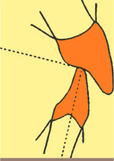 Fig. 2 Situation du point d’impact en PIM.