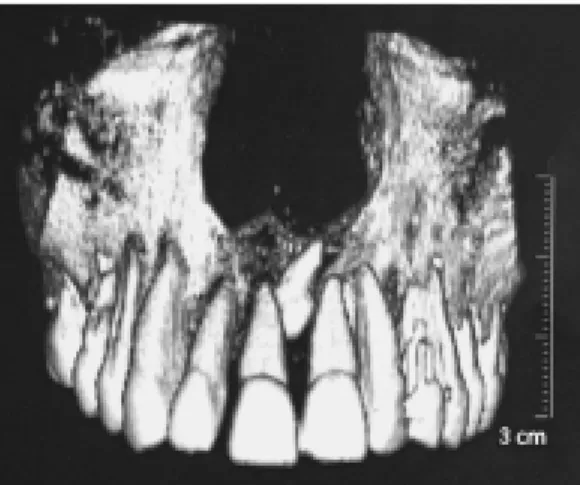 Fig. 13 b Reconstructions orthogonales. Fig. 13 c Reconstruction en trois dimensions.