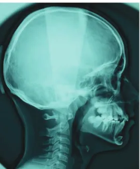 Fig. 1 a et 1 b Examen clinique endobuccal.