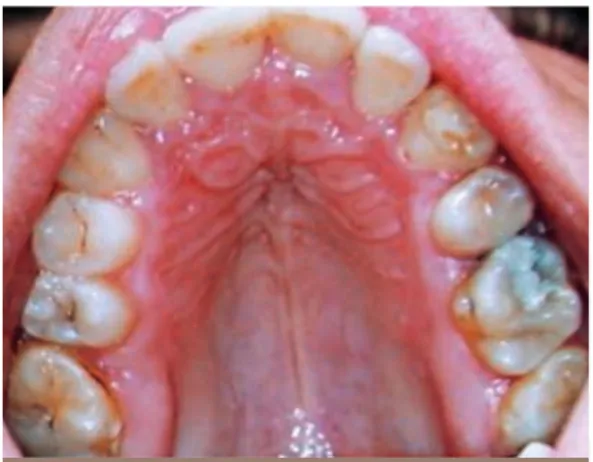 Fig. 8 Extractions asymétriques 16-24.