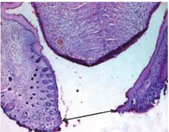 Fig. 11 (HEx40) : langue bifide.