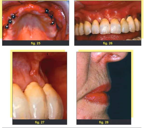 fig. 25 fig. 26