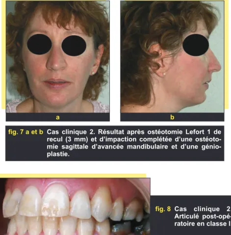 fig. 8 Cas clinique 2.