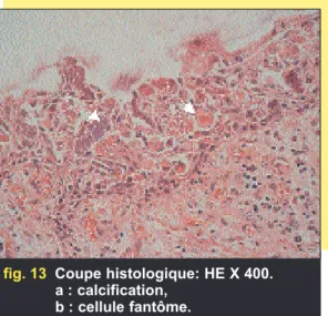 fig. 12 Coupe histologique: HE X 100.