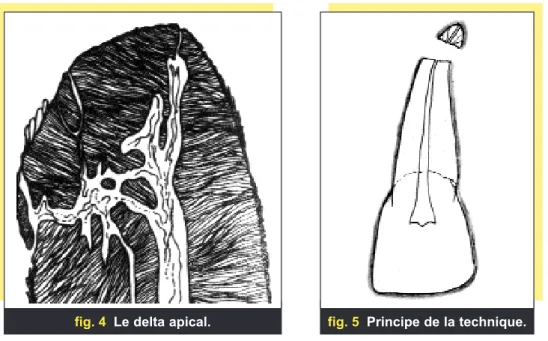 fig. 5 Principe de la technique.