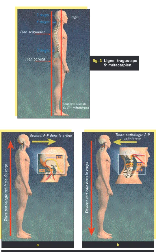 fig. 3 Ligne tragus-apo 5 e métacarpien.