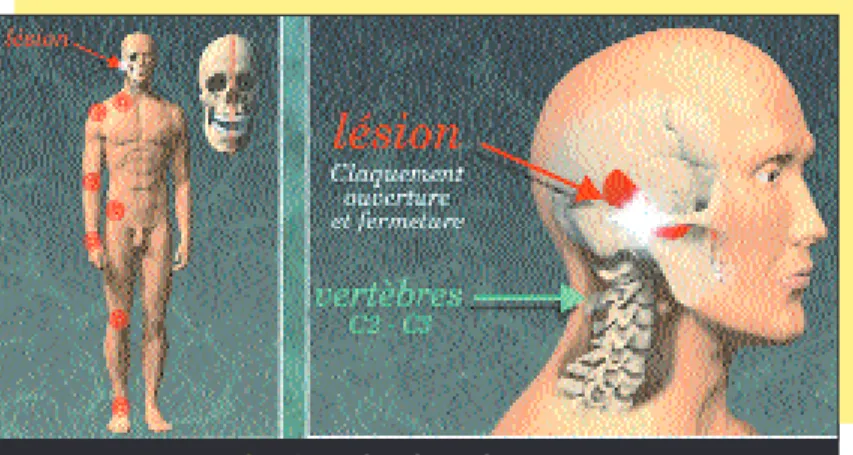 fig. 10 b Schéma lésionnel.