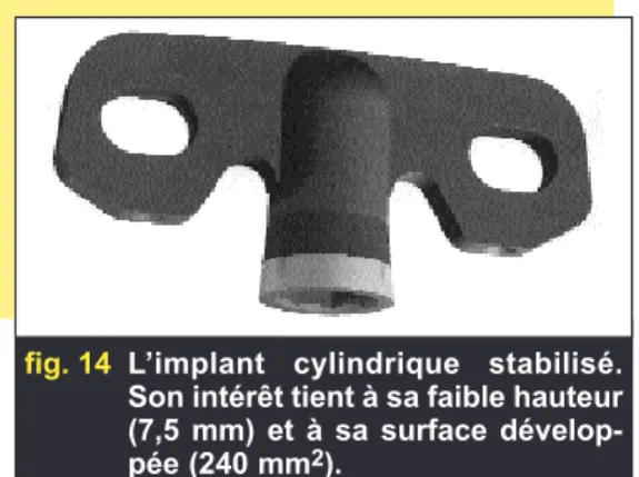 fig. 14 L’implant cylindrique stabilisé.