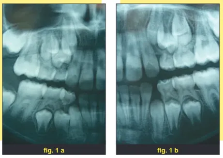 fig. 1 a fig. 1 b
