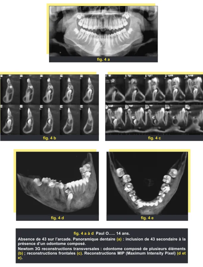 fig. 4 efig. 4 d