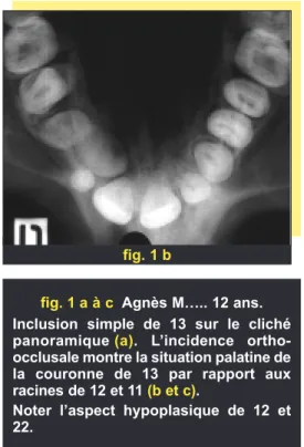 fig. 1 cfig. 1 a