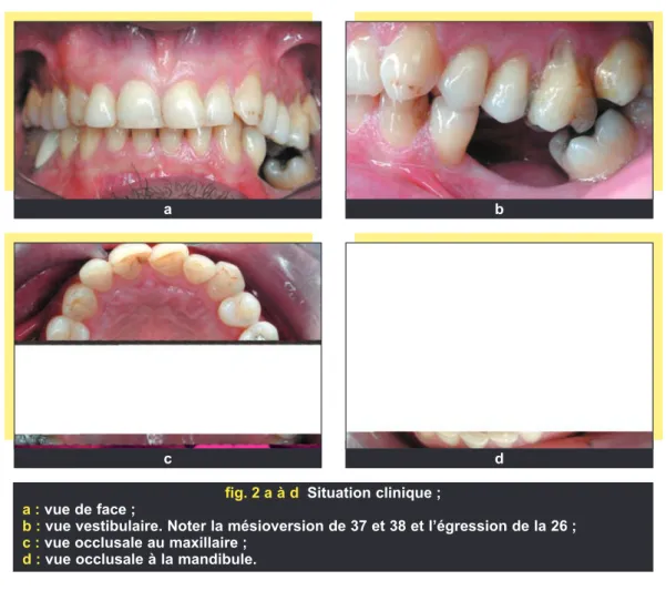 fig. 2 a à d Situation clinique ; a : vue de face ;