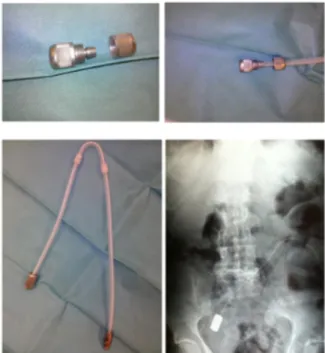 Figure 1 : Lest en acier inoxydable utilisé dans l’étude