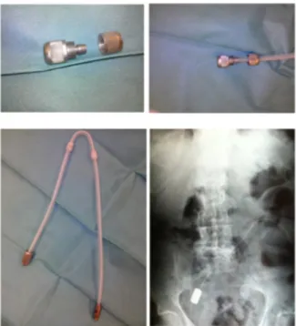 Figure 1 : Stainless steel ballast used in the study