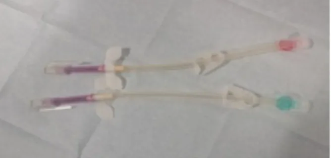 Figure 3. Foam needles with plastic devices to remove crusts