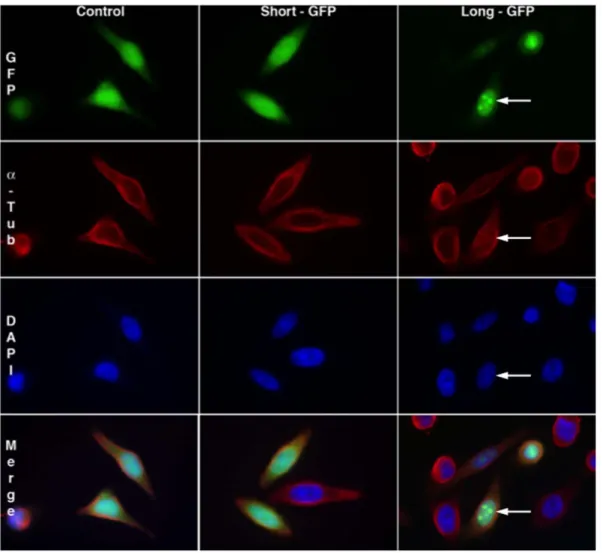 Figure 1. Subcellular localization of GFP fused with the short or long N-terminal sequence of Ilf3/NF90