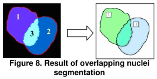 Figure 8. Result of overlapping nuclei  segmentation 