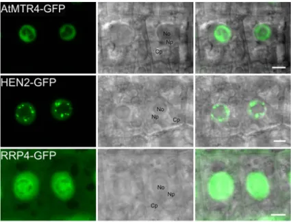 Figure 3. MTR4 and HEN2 have distinct localization patterns. Distribution of GFP-fusion proteins in root cells of stable Arabidopsis transformants