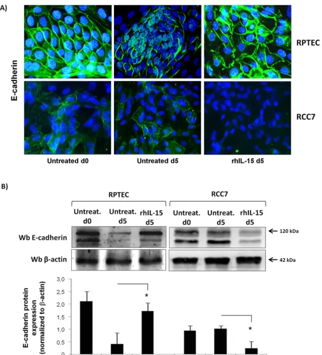 Figure 4. Soluble IL-15, at physiologic concentration, differently controls E-cadherin expression in RCC and RPTEC.