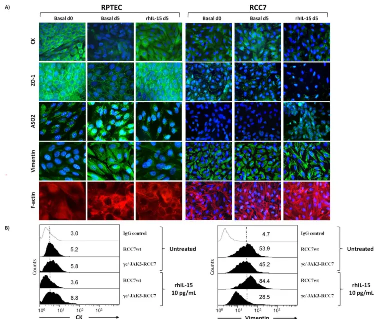 Figure 7. E-cadherin modulation by soluble IL-15 controls epithelial-mesenchymal transition on renal epithelial cells