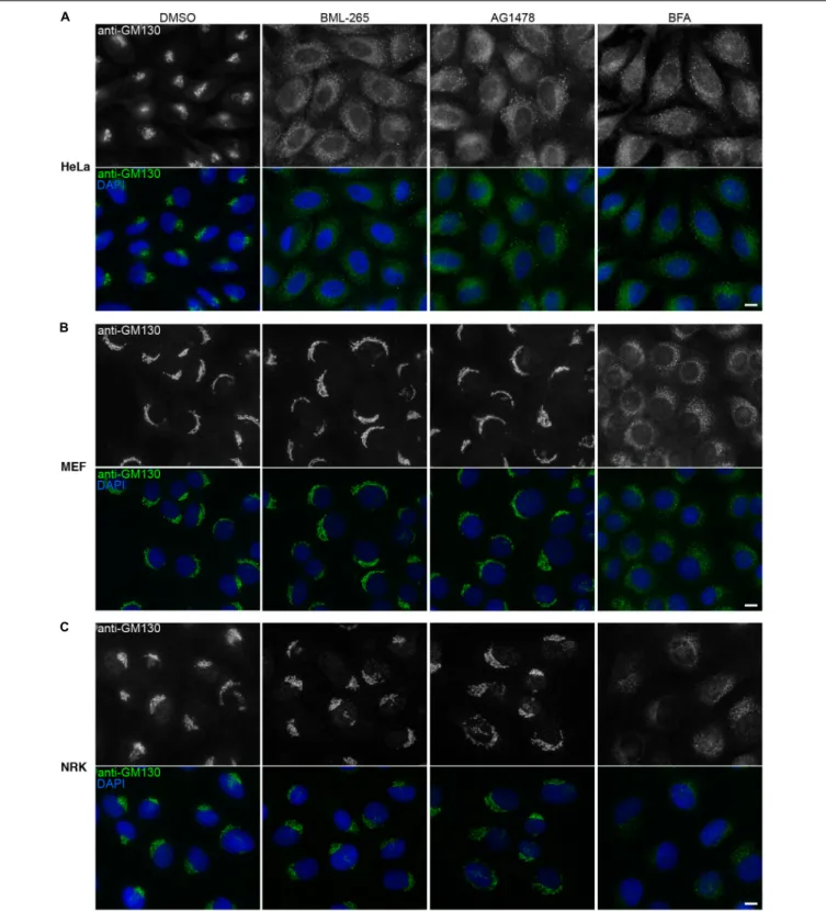 FIGURE 4 | BML-265 affects Golgi integrity in human cells but not in rodent cells. HeLa cells (A), mouse embryonic fibroblasts (MEF) (B) or normal rat kidney (NRK) cells (C) were incubated with the indicated molecules at 10 µ M final for 1h30