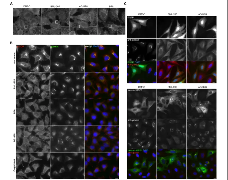 FIGURE 6 | BML-265 exerts its effects on Golgi integrity and trafficking through targeting GBF1