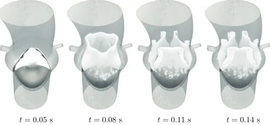 Figure 8: Backward time FTLE reveals attracting LCS (white) that bound the blood ejected from the tricuspid valve as it opens.