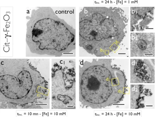 Figure 4 : Transmission electron microscopy (TEM) images of lymphoblastoid cells incubated with Cit–γ-Fe 2 O 3 NPs