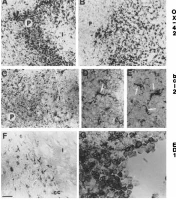 Figure 4. Microglia/macrophage activation in neonatal ische- ische-mia/reperfusion identified by immunocytochemistry using the OX-42 antibody