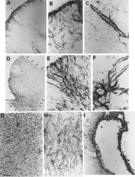 Figure 5. Morphological remnants of astro- astro-cytes in neonatal ischemia/reperfusion  identi-fied by immunohistochemistry using the GFAP antibody