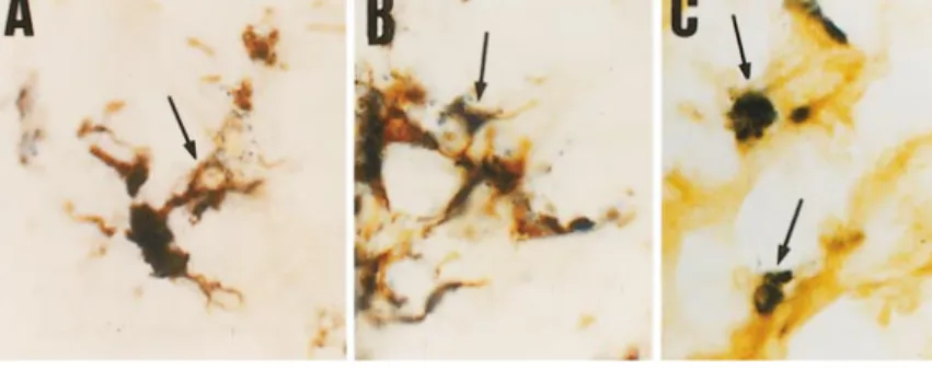 Figure 7. Double staining of dying astrocytes (A), microglia (B), and macrophages (C) identified by immunocytochemistry using Bax, GFAP, OX-42, and ED1 antibodies