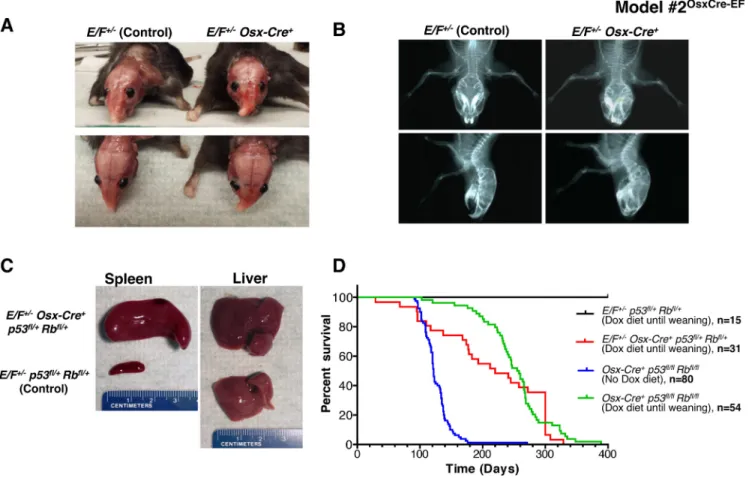 Figure 1: Postnatal expression of EWS-FLI1 in cells with the activated Osterix promoter in E/F +/-  Osx-Cre +  mice with  or without p53 and pRb deletion in Model #2 OsxCre-EF 