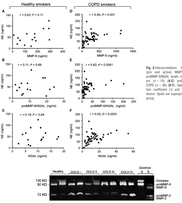 Fig. 4 Levels of proMMP-2 and proMMP-9 in serum samples from healthy and COPD smokers