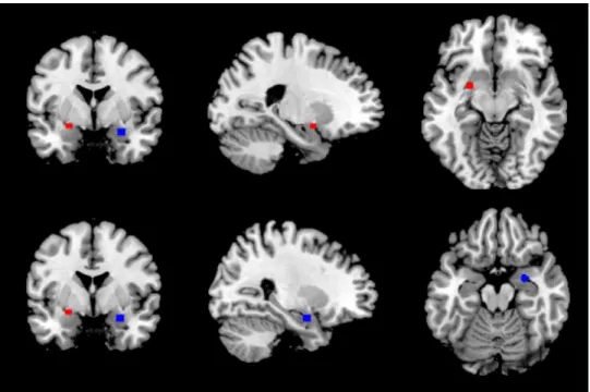 Figure 2. Amygdala regions of interest (ROIs). Bilateral amygdala ROIs based on Rule et al