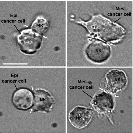 Fig. 2. Phase-contrast microscopy showing conjugates of Epi cancer cell, or Mes cancer cells, with NK lymphocytes (NK92) formed after coculturing the cells for 30 min