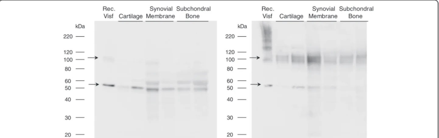 Figure 1 Intratissular expression of visfatin/Nampt from osteoarthritic human joint tissues