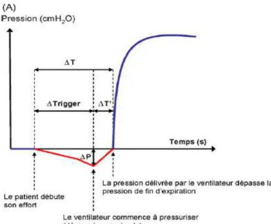 Figure 2 : Qualité du trigger inspiratoire: Tiré de Thille, Lyazidi, Richard et Brochard, 2008, p