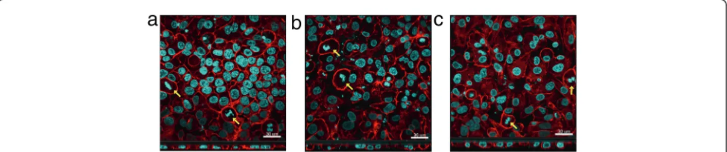 Figure 3 Cell morphology of CNC exposed cell cultures. Confocal laser scanning microscopy analyzes visualising the actin cytoskeleton (red) and the nuclei (cyan) of control (a) or 1.57 μ g/cm 2 of either c-CNCs (b) or t-CNC (c) exposed cells