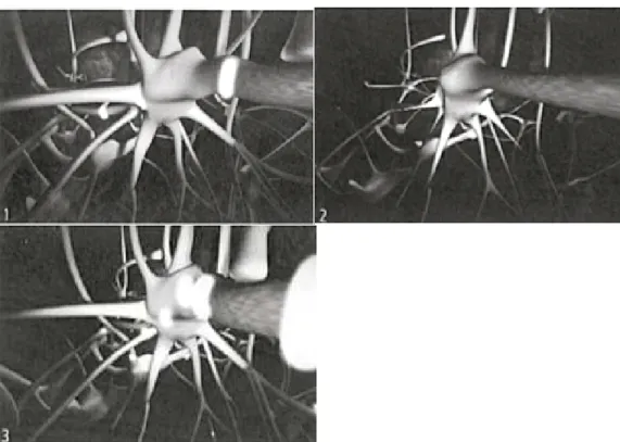 Fig.  2 :  Représentation  des  connexions  nerveuses  (d’après  Casey,  2000,  cité  par  Zahner  et  Dösegger,  2004,  p.51)  1)  en  haut  à  gauche :  situation  de  départ,  2)  à  droite ;  stimulation  déficiente, 3) en bas ; stimulation grâce à l’e