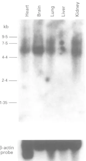 Figure 2 Expression analysis of the ZNF6 gene. A human multiple fetal tissue northern blot (Clontech) was