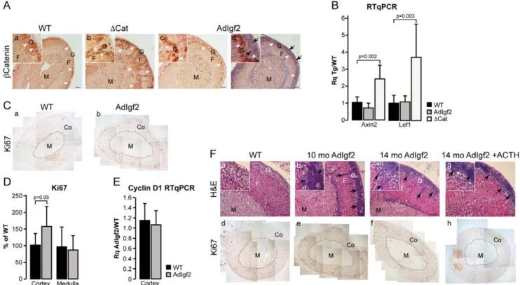 Figure 2. Igf2 overexpression does not initiate adrenal tumourigenesis. A- b-catenin is not activated in AdIgf2 adrenals