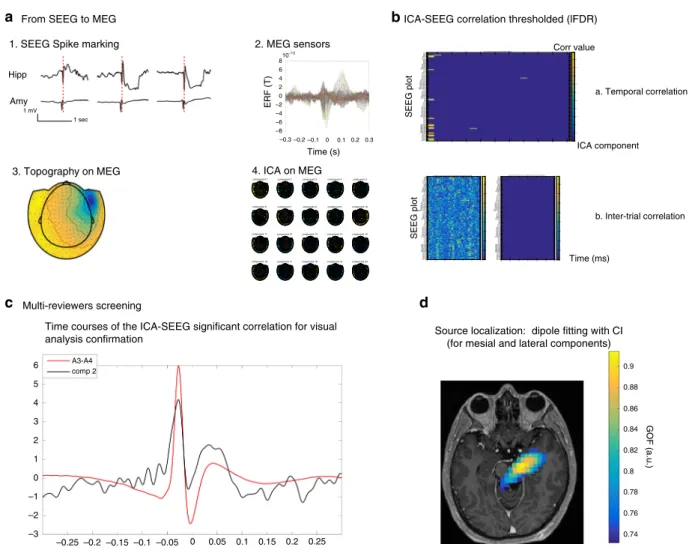 Fig. 5 Methods. Example of SEEG-triggered analysis in P5. a 1. Spike marking on SEEG. Hippocampus and amygdala activity (almost simultaneous): in red marker position based on hippocampus activity 2