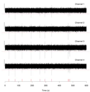Figure 1: Detection of LFP activity on the first time-derivative of the data. The same scale applies to all channels (vertical bar: 200 µV / ms)
