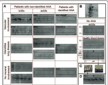 Figure 3 IgG reactivities directed toward lamin A/C. (A) Areas of 2-D membranes with IgG reactivities directed toward lamin A/C in sera from patients with different subsets of SSc and from healthy blood donors in total or nuclear (*) protein extracts from 