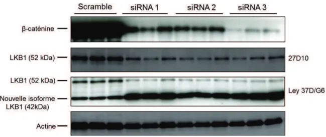 Figure 26: Expression protéique des formes longue « classique » et courte « nouvelle  isoforme  »  de  LKB1  après  interférence  par  trois  ARNs  dirigés  contre  la  •-caténine,  dans la lignée hépatomateuse humaine HuH6