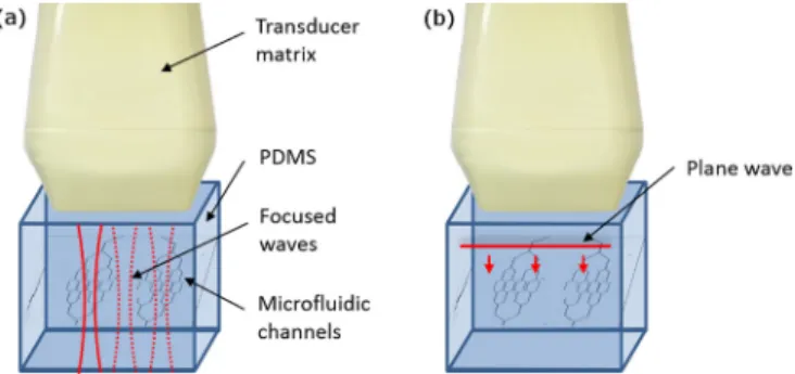 FIG. 1. Plane wave imaging compared to focused imaging. These two tech- tech-niques were applied on microchannels inside PDMS imaged with a 1.75 MHz 2D transducer matrix connected to an ultrafast ultrasonic scanner (ultrafast frame rate: 1 kHz)