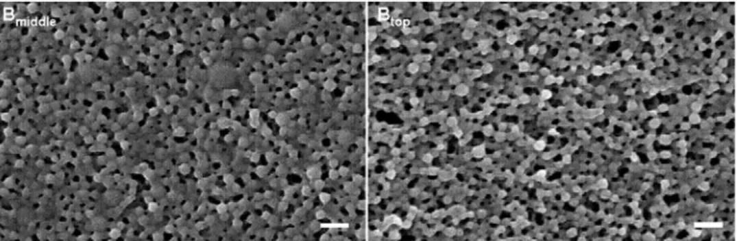 Figure 1: Scanning electron micrographs of Type B nanoparticles. Lyophilized powder coated with a 2  nm thick Pt/Pd layer. Scale bar = 200 nm. 