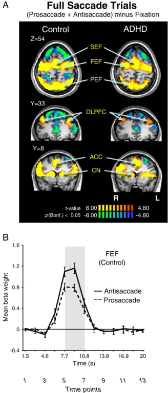 Fig. 3. (A) Contrast map of correct prosaccade trials and antisaccade trials added to- to-gether, cluster size corrected at pb .05 (9 contiguous voxels)